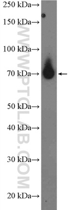 ADAM10 Antibody in Western Blot (WB)