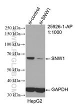 SNW1 Antibody in Western Blot (WB)