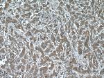 IQGAP3 Antibody in Immunohistochemistry (Paraffin) (IHC (P))