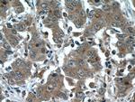 IQGAP3 Antibody in Immunohistochemistry (Paraffin) (IHC (P))