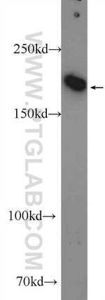 IQGAP3 Antibody in Western Blot (WB)