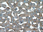 TCHP Antibody in Immunohistochemistry (Paraffin) (IHC (P))