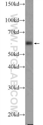 TCHP Antibody in Western Blot (WB)