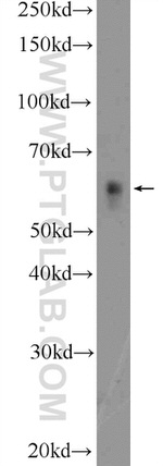 c-SRC Antibody in Western Blot (WB)