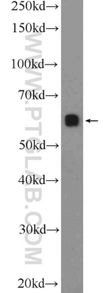 c-SRC Antibody in Western Blot (WB)