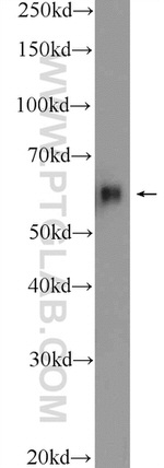 c-SRC Antibody in Western Blot (WB)