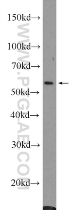 c-SRC Antibody in Western Blot (WB)