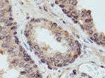 KIF14 Antibody in Immunohistochemistry (Paraffin) (IHC (P))