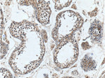 SRD5A1 Antibody in Immunohistochemistry (Paraffin) (IHC (P))