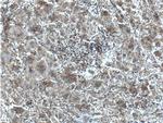 SRD5A1 Antibody in Immunohistochemistry (Paraffin) (IHC (P))