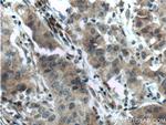 SRD5A1 Antibody in Immunohistochemistry (Paraffin) (IHC (P))