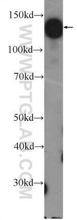 HISPPD1 Antibody in Western Blot (WB)