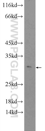 C9orf9 Antibody in Western Blot (WB)