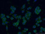 IGSF2 Antibody in Immunocytochemistry (ICC/IF)