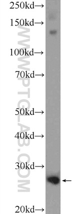 CFD Antibody in Western Blot (WB)