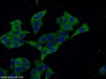 Ezrin Antibody in Immunocytochemistry (ICC/IF)