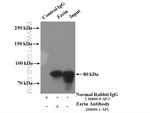 Ezrin Antibody in Immunoprecipitation (IP)