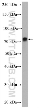 Ezrin Antibody in Western Blot (WB)