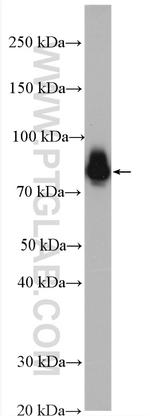 Ezrin Antibody in Western Blot (WB)