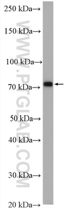 Ezrin Antibody in Western Blot (WB)