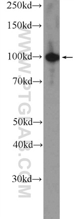 ZC3H11A Antibody in Western Blot (WB)