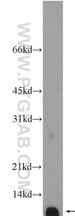 C16orf61 Antibody in Western Blot (WB)