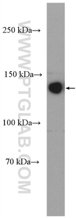 ECE1 Antibody in Western Blot (WB)