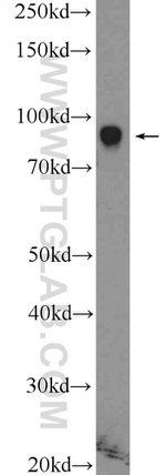 ZNF184 Antibody in Western Blot (WB)