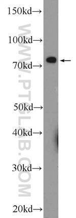 RDX Antibody in Western Blot (WB)