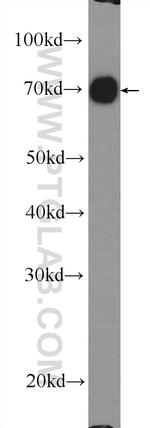 RDX Antibody in Western Blot (WB)