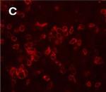 Secretogranin II Antibody in Immunohistochemistry (IHC)