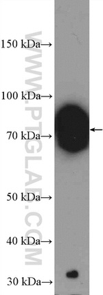 ZFP90 Antibody in Western Blot (WB)