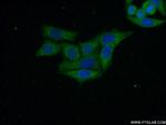 C14orf28 Antibody in Immunocytochemistry (ICC/IF)