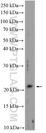 C1orf86 Antibody in Western Blot (WB)