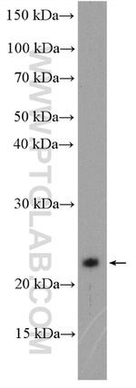 C1orf86 Antibody in Western Blot (WB)