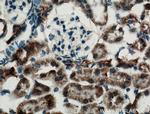 NBCe2 Antibody in Immunohistochemistry (Paraffin) (IHC (P))