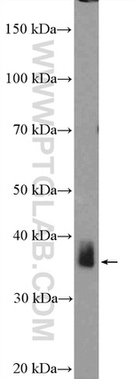 ZC3H8 Antibody in Western Blot (WB)