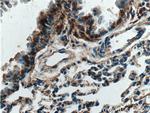 Vegfa Antibody in Immunohistochemistry (Paraffin) (IHC (P))