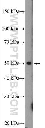 METTL14 Antibody in Western Blot (WB)