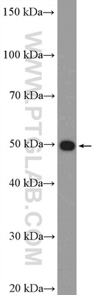 NCAPH2 Antibody in Western Blot (WB)