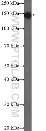 EIF3A Antibody in Western Blot (WB)