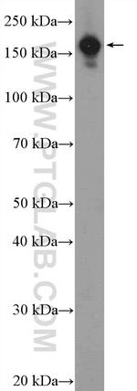 EIF3A Antibody in Western Blot (WB)