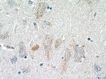 GLDN Antibody in Immunohistochemistry (Paraffin) (IHC (P))