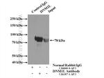 DRP1 (N-terminal) Antibody in Immunoprecipitation (IP)