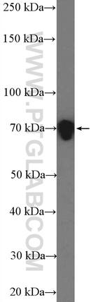 DRP1 (N-terminal) Antibody in Western Blot (WB)