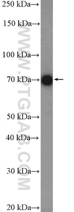 DRP1 (N-terminal) Antibody in Western Blot (WB)
