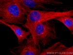 gamma tubulin Antibody in Immunocytochemistry (ICC/IF)