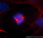 gamma tubulin Antibody in Immunocytochemistry (ICC/IF)