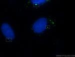 gamma tubulin Antibody in Immunocytochemistry (ICC/IF)