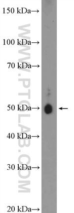 gamma tubulin Antibody in Western Blot (WB)